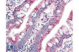 anti-Zinc Finger Protein 652 (ZNF652) (AA 594-606) antibody