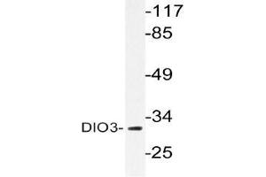 Western blot (WB) analysis of DIO3 antibody in extracts from HUVEC cells. (DIO3 anticorps)