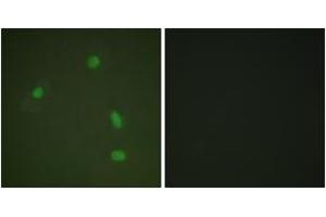 Immunofluorescence analysis of A549 cells, using Progesterone Receptor (Phospho-Ser400) Antibody.