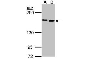 DIAPH1 anticorps  (N-Term)