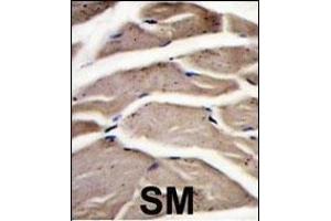 Formalin-fixed and paraffin-embedded human skeletal muscle reacted with PFKM Antibody (C-term) (ABIN392749 and ABIN2842203) , which was peroxidase-conjugated to the secondary antibody, followed by DAB staining.