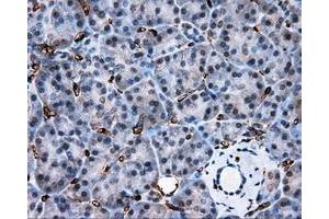 Immunohistochemical staining of paraffin-embedded liver tissue using anti-AKR1A1 mouse monoclonal antibody. (AKR1A1 anticorps)