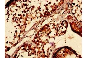 Immunocytochemistry analysis of human testis tissue using ABIN7171476 at dilution of 1:100