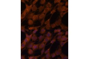Immunofluorescence analysis of C6 cells using Legumain (Legumain (LGMN)) Polyclonal Antibody (ABIN6128201, ABIN6143172, ABIN6143173 and ABIN6214867) at dilution of 1:100 (40x lens). (LGMN anticorps  (AA 18-323))