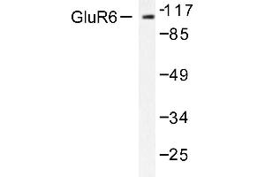 Image no. 1 for anti-Glutamate Receptor, Ionotropic, Kainate 2 (GRIK2) antibody (ABIN265439) (GRIK2 anticorps)