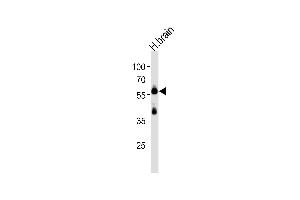Western blot analysis of lysate from human brain tissue lysate, using CSIN1 Antibody  (ABIN392665 and ABIN2842163).