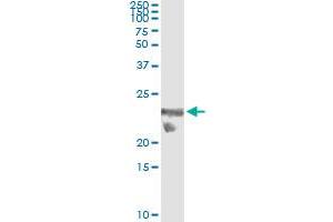 Immunoprecipitation of TSC22D3 transfected lysate using anti-TSC22D3 monoclonal antibody and Protein A Magnetic Bead , and immunoblotted with TSC22D3 MaxPab rabbit polyclonal antibody.