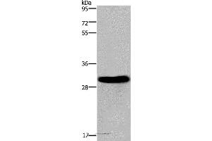 Western blot analysis of Mouse heart tissue, using FHL2 Polyclonal Antibody at dilution of 1:2400 (FHL2 anticorps)