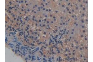 Detection of ICAM2 in Rat Adrenal gland Tissue using Polyclonal Antibody to Intercellular Adhesion Molecule 2 (ICAM2) (ICAM2 anticorps  (AA 29-247))