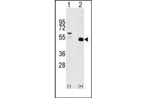 Image no. 1 for anti-TNF Receptor-Associated Factor 2 (TRAF2) (C-Term) antibody (ABIN360166) (TRAF2 anticorps  (C-Term))
