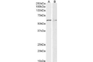 ABIN5539533 (2µg/ml) staining of HeLa (A) and K562 (B) lysates (35µg protein in RIPA buffer). (GPC1 anticorps  (Internal Region))
