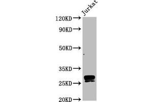 Western Blot Positive WB detected in Jurkat whole cell lysate All lanes CD99 antibody at 0.