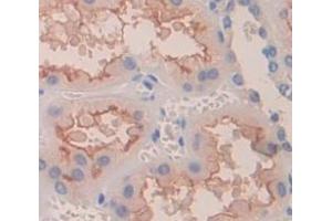 IHC-P analysis of Human Tissue, with DAB staining. (LDHB anticorps  (AA 1-334))