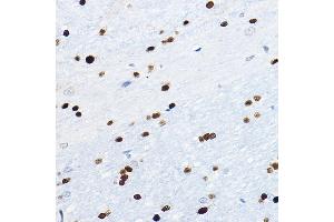 Immunohistochemistry of paraffin-embedded mouse brain using SOX10 Rabbit pAb (ABIN7270568) at dilution of 1:100 (40x lens). (SOX10 anticorps  (AA 200-300))