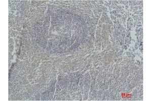 Immunohistochemical analysis of paraffin-embedded Human Tonsil Tissue using Active Caspase-3 Monoclonal Antibody.