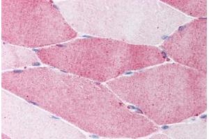 Human Skeletal Muscle (formalin-fixed, paraffin-embedded) stained with FBN1 antibody ABIN214104 at 5 ug/ml followed by biotinylated goat anti-rabbit IgG secondary antibody ABIN481713, alkaline phosphatase-streptavidin and chromogen.