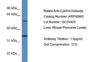 Western Blotting (WB) image for anti-Cytochrome B5 Reductase 4 (CYB5R4) (N-Term) antibody (ABIN2786943) (CYB5R4 anticorps  (N-Term))