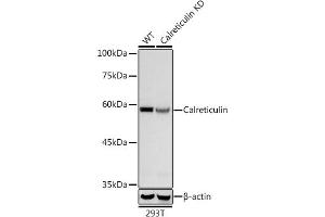 Western blot analysis of extracts from wild type (WT) and PD-1/CD279 knockdown (KD) 293T cells, using PD-1/CD279 antibody (ABIN7266042) at 1:1000 dilution. (Calreticulin anticorps)