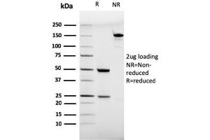 SDS-PAGE Analysis Purified CD28 Mouse Monoclonal Antibody (C28/75). (CD28 anticorps)