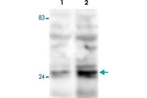 Western blot was performed on whole cell lysates from mouse fibroblasts (Lane 1, NIH/3T3) and embryonic stem cells (Lane 2, E14Tg2a) with Fkbp3 polyclonal antibody , diluted 1 : 500 in BSA/PBS-Tween.