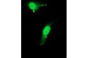 Image no. 3 for anti-Cystatin C (CST3) antibody (ABIN1497755)