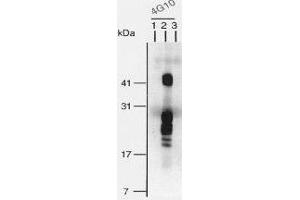 Western Blotting (WB) image for anti-Heparin-Binding EGF-Like Growth Factor (HBEGF) (Bound), (EGF Like Domain), (Soluble) antibody (ABIN3201018)