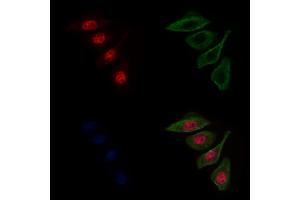 ABIN6263168 and ABIN6272598 staining Hela cells by IF/ICC. (MCM8 anticorps  (C-Term))
