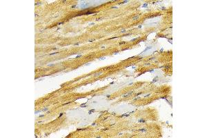 Immunohistochemistry of paraffin-embedded rat heart using COPS3 Rabbit mAb (ABIN7266498) at dilution of 1:100 (40x lens). (COPS3 anticorps)
