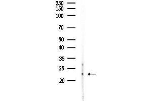 anti-Ubiquitin-Conjugating Enzyme E2M (ube2m) (Internal Region) antibody