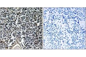 Immunohistochemistry analysis of paraffin-embedded human thymus gland, using ABCB7 Antibody.
