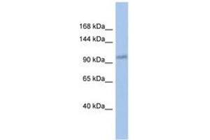 Image no. 1 for anti-DEAD (Asp-Glu-Ala-Asp) Box Polypeptide 24 (DDX24) (C-Term) antibody (ABIN6742691) (DDX24 anticorps  (C-Term))