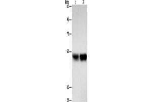Western blot analysis of Hela cells A431 cells using ZFYVE19 Polyclonal Antibody at dilution of 1:500 (ZFYVE19 anticorps)