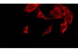 ABIN6276241 staining HeLa by IF/ICC. (OR10G4 anticorps  (C-Term))