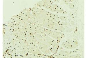 ABIN6268848 at 1/100 staining Mouse muscle tissue by IHC-P.
