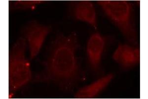 Image no. 1 for anti-Neurofibromin 2 (NF2) (pSer518) antibody (ABIN197028) (Merlin anticorps  (pSer518))