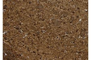 ABIN6267084 at 1/100 staining Rat brain tissue by IHC-P.