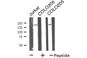 Western blot analysis of extracts from Jurkat/COLO205 cells, using MRCKa antibody. (CDC42BPA anticorps  (Internal Region))