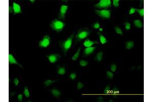 Immunofluorescence of monoclonal antibody to MKNK2 on HeLa cell.