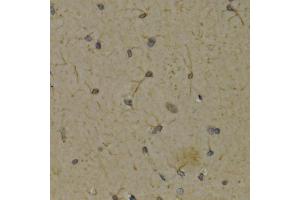 Immunohistochemistry of paraffin-embedded rat brain using ALOX5 antibody (ABIN5971185) at dilution of 1/200 (40x lens). (ALOX5 anticorps)