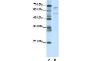 Western Blotting (WB) image for anti-TAF6-Like RNA Polymerase II, P300/CBP-Associated Factor (PCAF)-Associated Factor, 65kDa (TAF6L) antibody (ABIN2461793) (TAF6L anticorps)