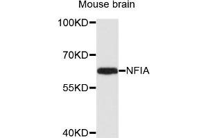 Western blot analysis of extracts of mouse brain cells, using NFIA antibody. (NFIA anticorps)