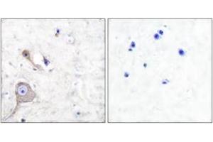 Immunohistochemistry analysis of paraffin-embedded human brain tissue, using S100 A1 Antibody.