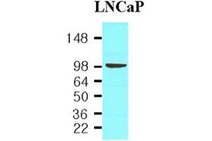 Western blot analysis: Cell lysates of LNCaP(30ug) were resolved by SDS-PAGE, transferred to NC membrane and probed with anti-human PSMA (1:1,000). (PSMA anticorps)