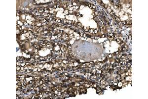 IHC analysis of Claudin 3/CLDN3 using anti-Claudin 3/CLDN3 antibody (ABIN7599626). (Claudin 3 anticorps  (AA 101-220))