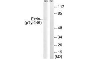Western blot analysis of extracts from 293 cells treated with UV 15', using Ezrin (Phospho-Tyr146) Antibody. (Ezrin anticorps  (pTyr146))