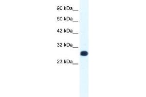 Human HepG2; WB Suggested Anti-GTF2F2 Antibody Titration: 1.