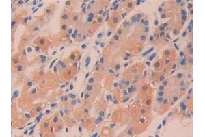 Detection of DDT in Human Stomach Tissue using Polyclonal Antibody to D-Dopachrome Tautomerase (DDT)