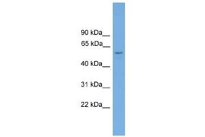 WB Suggested Anti-Toe1 Antibody Titration: 0. (TOE1 anticorps  (Middle Region))