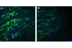 Expression of PACC1 in mouse reticular thalamic nucleus. (PACC1 (AA 95-110), (Extracellular) anticorps)