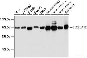 Western blot analysis of extracts of various cell lines using SLC25A12 Polyclonal Antibody at dilution of 1:3000. (SLC25A12 anticorps)